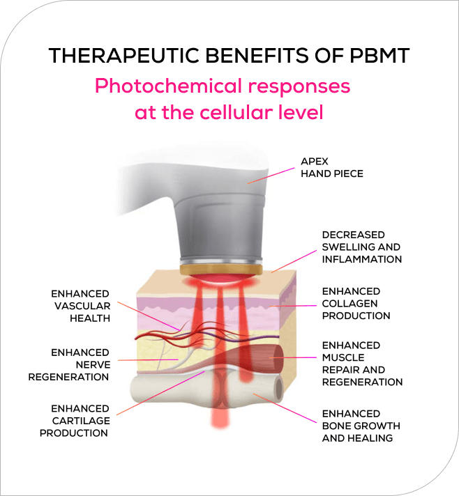 Therapeutic Benefits of PBMT
